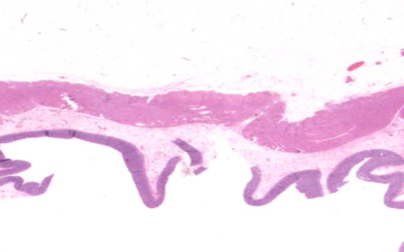 Medical Image Segmentation